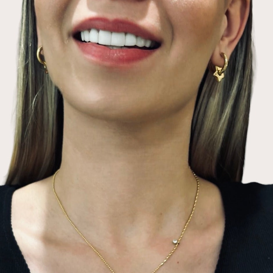 Aretes Dreams